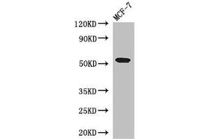 Western Blot Positive WB detected in: MCF-7 whole cell lysate All lanes: PSEN1 antibody at 3 μg/mL Secondary Goat polyclonal to rabbit IgG at 1/50000 dilution Predicted band size: 53, 43, 22, 47, 49 kDa Observed band size: 53 kDa (Presenilin 1 抗体  (AA 4-218))