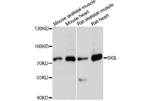 Western blot analysis of extracts of various cell lines, using SKIL antibody (ABIN6292273) at 1:3000 dilution. (SKIL 抗体)