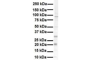 WB Suggested Anti-KRAS antibody Titration: 1 ug/mL Sample Type: Human RPMI-8226 (K-RAS 抗体  (N-Term))