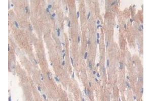 Immunohistochemistry (IHC) image for anti-Citrate Synthase (CS) (AA 56-312) antibody (ABIN7440653)