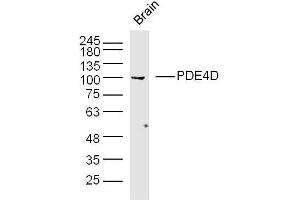 Mouse brain lysates probed with PDE4D Polyclonal Antibody, unconjugated  at 1:300 overnight at 4°C followed by a conjugated secondary antibody at 1:10000 for 90 minutes at 37°C. (PDE4D 抗体  (AA 401-550))