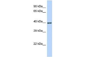 Host:  Rabbit  Target Name:  ZNF607  Sample Type:  Jurkat Whole Cell lysates  Antibody Dilution:  1. (ZNF607 抗体  (N-Term))