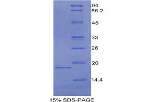 SDS-PAGE analysis of Mouse CEA Protein. (CEA 蛋白)