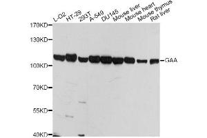 Western blot analysis of extracts of various cell lines, using GAA antibody (ABIN5974462) at 1/1000 dilution. (GAA 抗体)