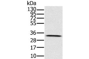 Western Blot analysis of Human testis tissue using HSD17B8 Polyclonal Antibody at dilution of 1:650 (HSD17B8 抗体)