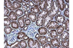 Immunohistochemistry (IHC) image for anti-Propionyl CoA Carboxylase beta Polypeptide (PCCB) (Center) antibody (ABIN2856061)