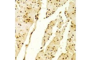 Immunohistochemistry of paraffin-embedded Human esophageal using MSH2 antibody at dilution of 1:100 (x400 lens). (MSH2 抗体  (AA 1-300))