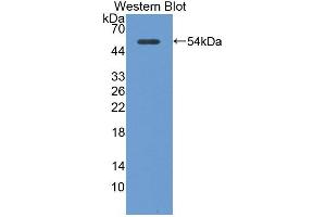 Western blot analysis of the recombinant protein. (RGS1 抗体  (AA 1-209))