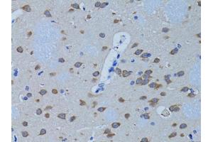 Immunohistochemistry of paraffin-embedded rat brain using PLCB1 antibody (ABIN3022698, ABIN3022699, ABIN3022700, ABIN1513385 and ABIN6219126) at dilution of 1:100 (40x lens).