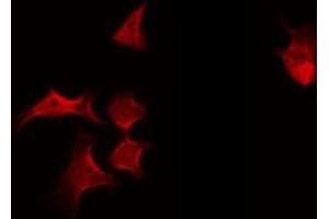 ABIN6269225 staining HeLa by IF/ICC. (alpha Adducin 抗体)