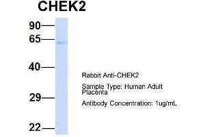 Host:  Rabbit  Target Name:  CHEK2  Sample Type:  Human Adult Placenta  Antibody Dilution:  1. (CHEK2 抗体  (N-Term))