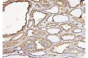 IHC analysis of CALR using anti-CALR antibody (ABIN7600329). (Calreticulin 抗体  (AA 18-323))