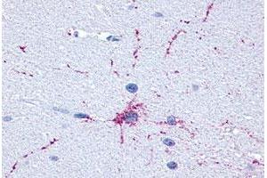Immunohistochemical (Formalin/PFA-fixed paraffin-embedded sections) staining in human brain, neurons and glia with GRM8 polyclonal antibody . (GRM8 抗体  (C-Term))