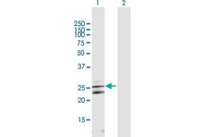 Western Blot analysis of CLCF1 expression in transfected 293T cell line by CLCF1 MaxPab polyclonal antibody.