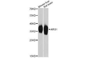 Western blot analysis of extracts of various cell lines, using ARG1 Antibody.