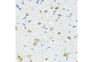 Immunohistochemistry of paraffin-embedded Rat brain using Nestin antibody (ABIN6128335, ABIN6144536, ABIN6144537 and ABIN6215496) at dilution of 100 (40x lens). (Nestin 抗体  (AA 1392-1621))