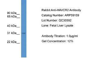 WB Suggested Anti-HAVCR2  Antibody Titration: 0. (TIM3 抗体  (C-Term))