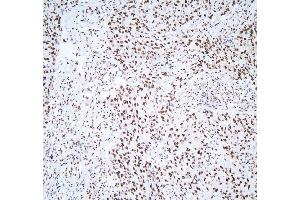 IHC analysis of HNRNPD using anti-HNRNPD antibody (ABIN7602590).