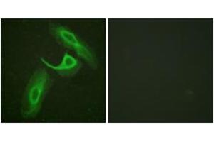 Immunofluorescence analysis of HeLa cells, using CD18/ITGB2 (Ab-758) Antibody. (Integrin beta 2 抗体  (AA 720-769))