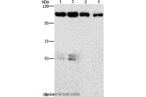 Western blot analysis of Hela and hepG2 cell, lovo cell and human colon cancer tissue, using CDK11A/CDK11B Polyclonal Antibody at dilution of 1:750 (CDK11 抗体)