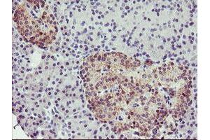 Immunohistochemical staining of paraffin-embedded Human pancreas tissue using anti-TMOD1 mouse monoclonal antibody. (Tropomodulin 1 抗体)