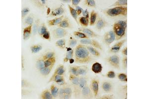 Immunohistochemistry (IHC) image for anti-Hyaluronidase-1 (HYAL1) (AA 32-47), (N-Term) antibody (ABIN3043999)