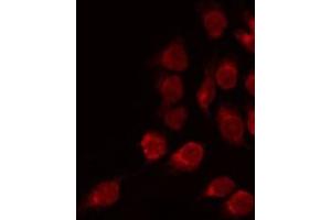 Immunofluorescence (fixed cells) (IF/ICC) image for anti-Potassium Voltage-Gated Channel, Subfamily G, Member 2 (Kcng2) (Internal Region) antibody (ABIN6258970)