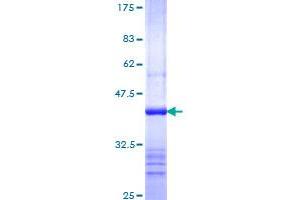 Image no. 1 for NP (AA 174-283) protein (GST tag) (ABIN1312838) (NP (AA 174-283) protein (GST tag))