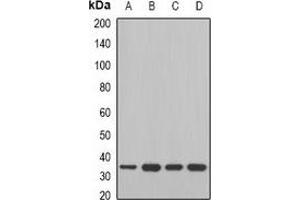 Western blot analysis of MDH2 expression in Jurkat (A), A549 (B), mouse liver (C), mouse heart (D) whole cell lysates.