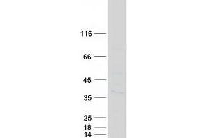 Western Blotting (WB) image for Centromere Protein P (CENPP) protein (Myc-DYKDDDDK Tag) (ABIN2713910)