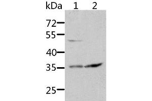 Western Blot analysis of HT-29 and 231 cell using SOCS1 Polyclonal Antibody at dilution of 1:1700 (SOCS1 抗体)