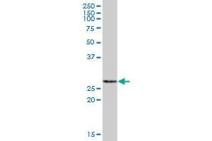 Western Blotting (WB) image for anti-Enoyl CoA Hydratase, Short Chain, 1, Mitochondrial (ECHS1) (AA 1-290) antibody (ABIN515146)