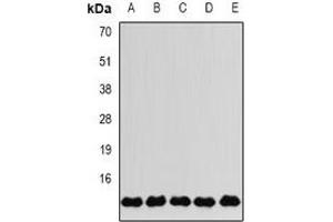 Western blot analysis of FKBP2 expression in MCF7 (A), SKOV3 (B), Jurkat (C), mouse liver (D), mouse brain (E) whole cell lysates. (FKBP2 抗体)