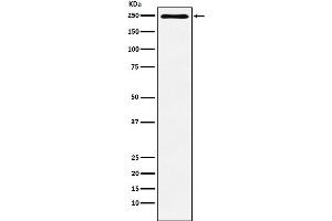 Western blot analysis of Plexin A1 expression in HUVEC cell lysate.