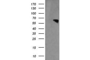 Image no. 1 for anti-Rhotekin (RTKN) antibody (ABIN1500702) (Rhotekin 抗体)