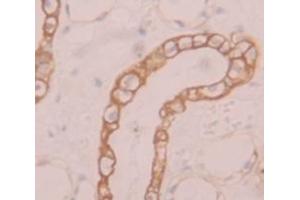 IHC-P analysis of Human Tissue, with DAB staining. (SLC39A6 抗体  (AA 29-325))