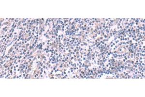 Immunohistochemistry of paraffin-embedded Human tonsil tissue using KCNK10 Polyclonal Antibody at dilution of 1:45(x200) (KCNK10 抗体)