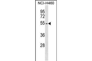 Western blot analysis in NCI-H460 cell line lysates (35ug/lane). (EPO 抗体  (AA 329-357))