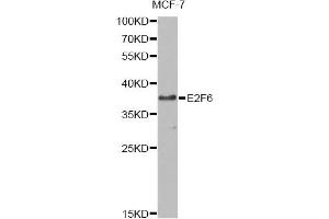 Western blot analysis of extracts of MCF-7 cells, using E2F6 antibody (ABIN6290326) at 1:1000 dilution. (E2F6 抗体)