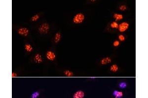 Immunofluorescence analysis of NIH/3T3 cells using TriMethyl-Histone H3-K64 Polyclonal Antibody at dilution of 1:100. (Histone 3 抗体  (3meLys64))