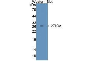 Detection of Recombinant IL17D, Rat using Polyclonal Antibody to Interleukin 17D (IL17D) (IL17D 抗体  (AA 76-274))