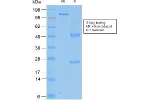 SDS-PAGE Analysis Purified TIMP2 Mouse Recombinant Monoclonal Antibody (rTIMP2/2335). (Recombinant TIMP2 抗体  (N-Term))