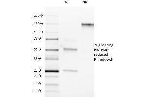 SDS-PAGE Analysis Purified ROR-gamma / RORC Mouse Monoclonal Antibody (RORC/2942). (RORC 抗体)