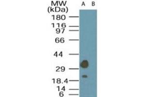 Western blot analysis of LYK5 in A-549 cell lysate in the (A) absence and (B) presence of immunizing peptide using LYK5 polyclonal antibody  at 1 ug/mL . (STRADA 抗体  (AA 300-350))
