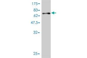 Western Blotting (WB) image for anti-Proteasome (Prosome, Macropain) 26S Subunit, ATPase, 4 (PSMC4) (AA 1-418) antibody (ABIN562488)
