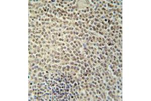 anti-RNA Binding Motif Protein, X-Linked 2 (RBMX2) (AA 245-265), (C-Term) antibody