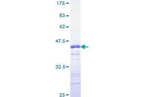 YY1 Protein (AA 221-320) (GST tag)