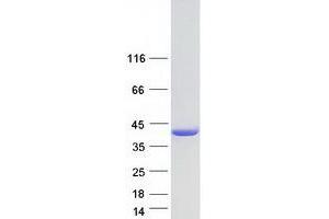 Western Blotting (WB) image for Poly(rC) Binding Protein 2 (PCBP2) (Transcript Variant 7) protein (Myc-DYKDDDDK Tag) (ABIN2728355)