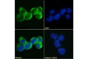 Immunofluorescence staining of Jurkat cells using anti-IL-9R antibody AH9R2. (Recombinant IL9 Receptor 抗体)