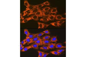 Immunofluorescence analysis of C6 cells using UQCRFS1 Rabbit mAb (ABIN7271127) at dilution of 1:100 (40x lens). (UQCRFS1 抗体)